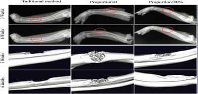 Application of plastic conjugated materials in the repair of sports injury